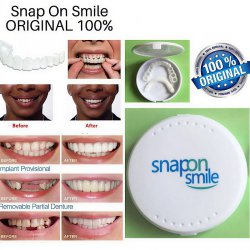 لمینت دندان دو فک مدل Snap on Smile